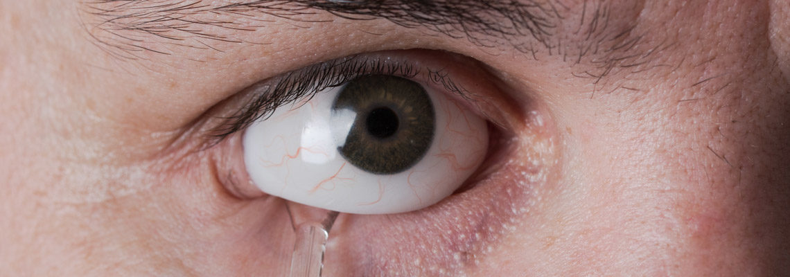 Prothèses oculaires